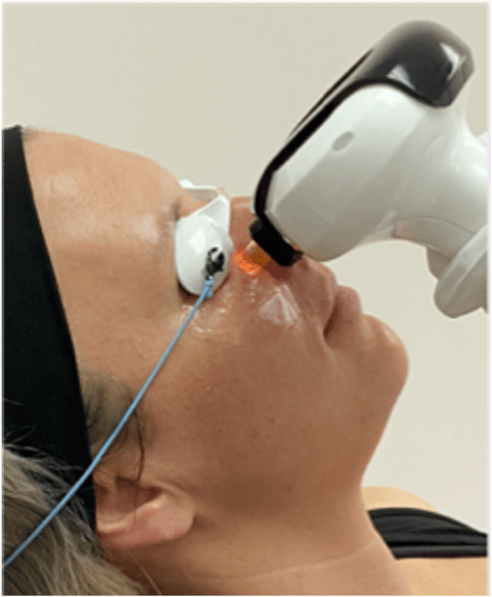 lumecca treatment 2